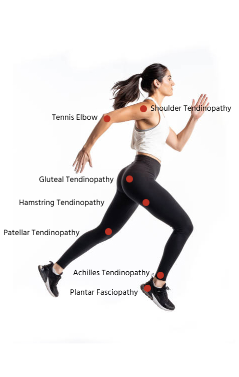 rehab runner