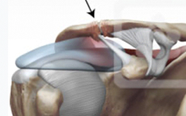 Acromioclavicular joint