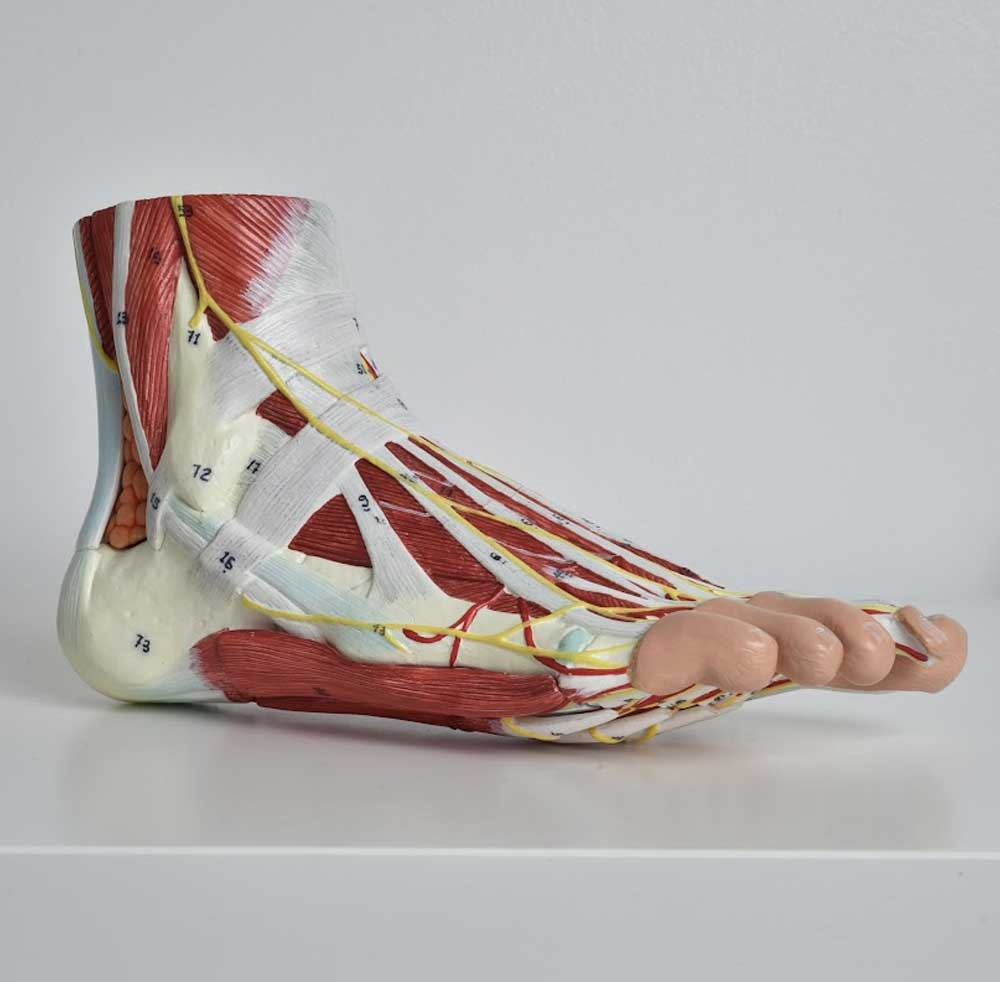 Achilles Tendinopathy 1 achillies tendinopathy